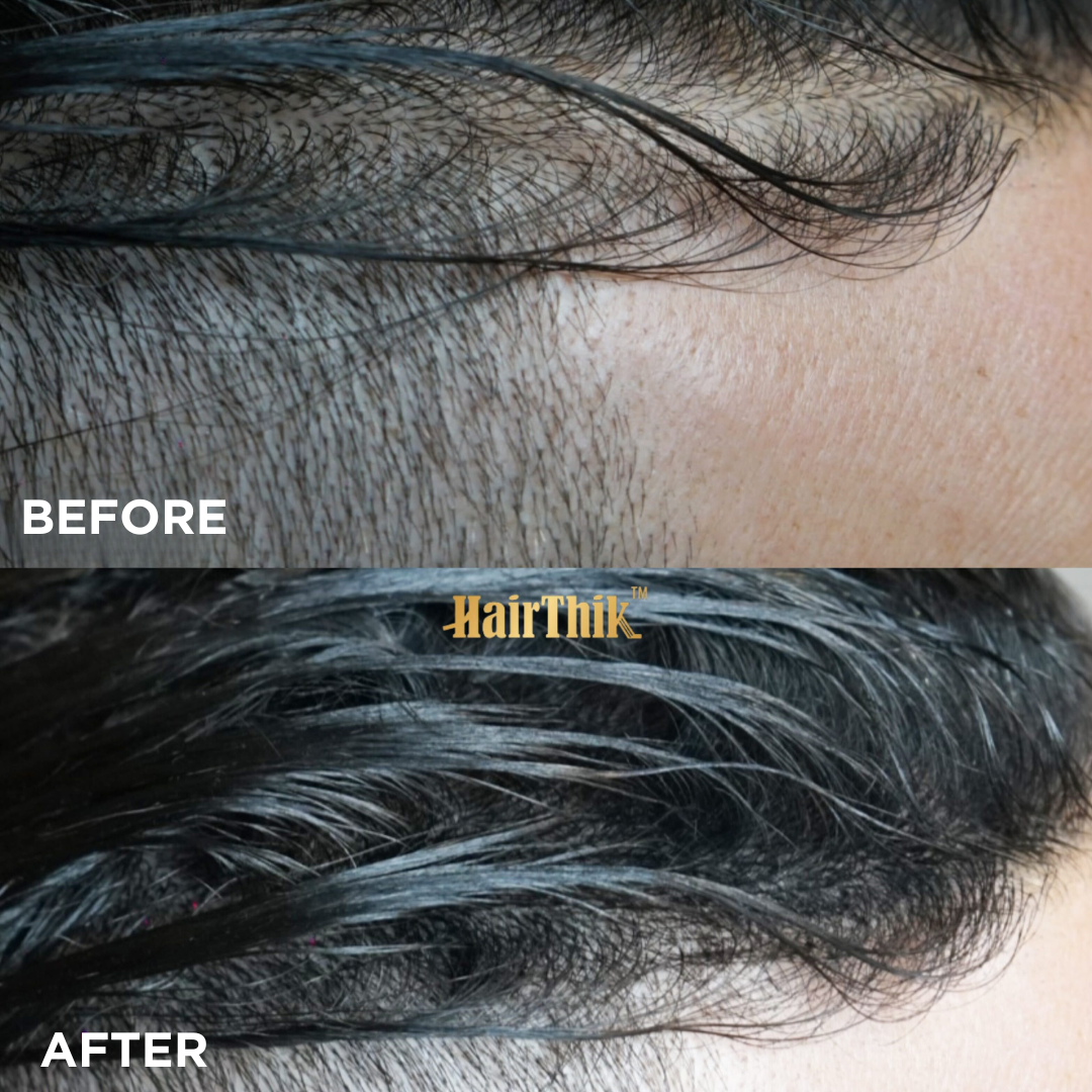 Hair Fibers 11-in-1 Master Finishing Kit